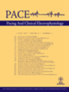 Pace-pacing And Clinical Electrophysiology